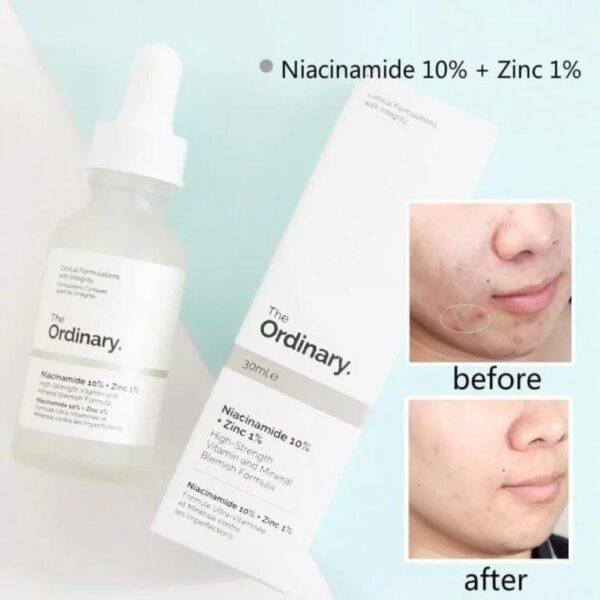 The Ordinary Niacinamide 10% + Zinc 1 % (30ml ) – With Barcode & Batch Code